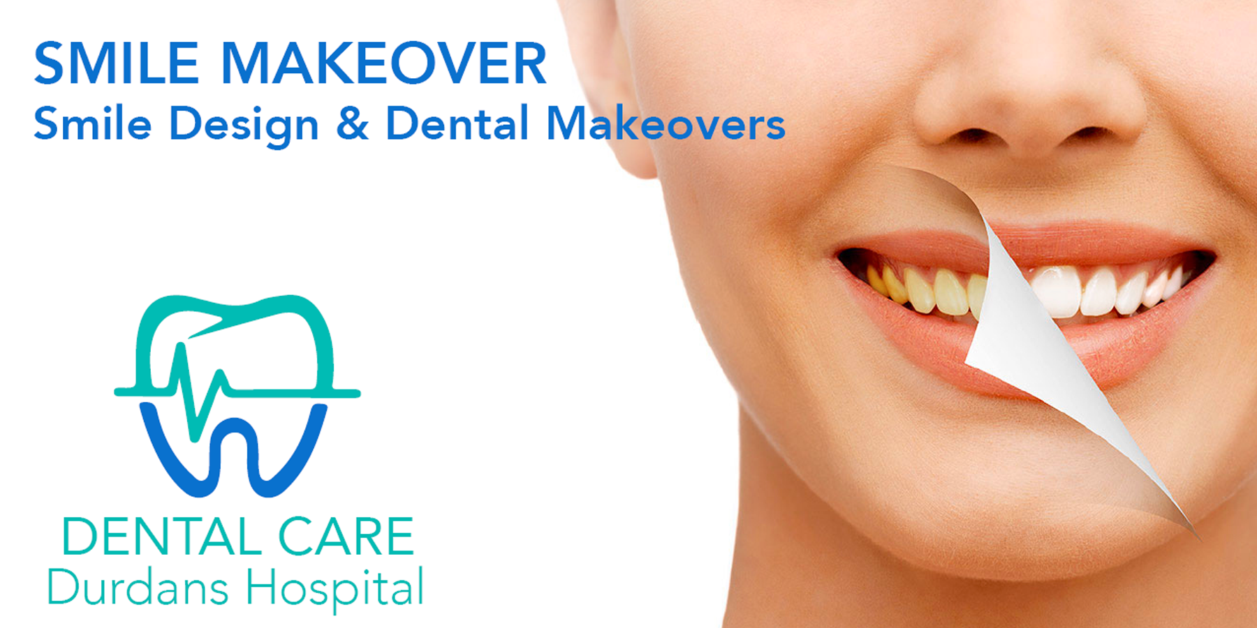 SmileMakeOver_image Get Your Perfect Smile with Durdans Dental Care