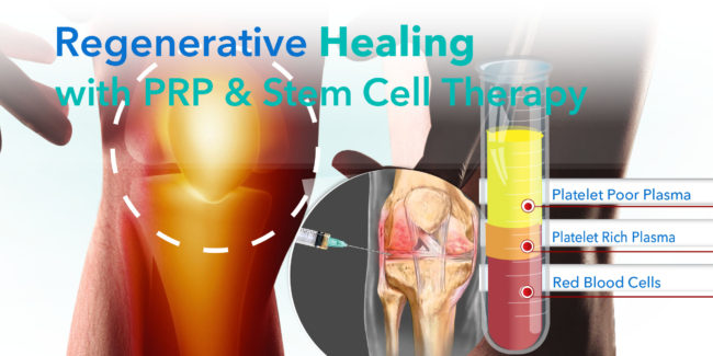 PRP_News paper Caption copy Transform Your Life with PRP and Stem Cell Therapy