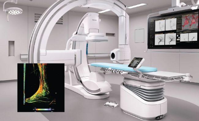 Biplane Catheterisation Unparalleled Vascular Procedures | Durdans Hospital