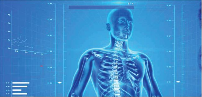 DEXA Scan for Osteoporosis Diagnosis | Get Accurate Results