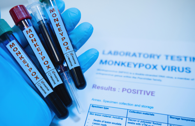 Monkey pox Is Monkeypox the Second Pandemic of the 21st Century?